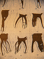 Grafik �ber die verschiedenen Wurzelf�llungen